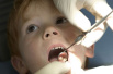 刷牙必须做到位　教你预防宝宝龋齿的七个绝招　