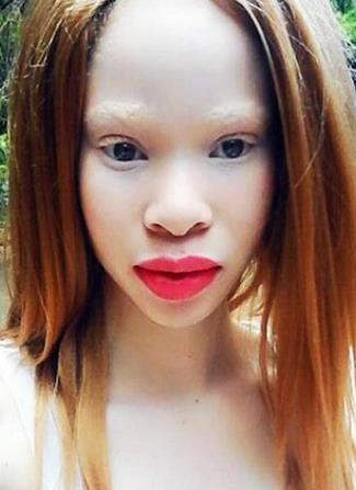 据了解，患有白化病的Nontobeko Mbuyazi皮肤非常苍白，就连她的眉毛都是白色的，为了躲避阳光，她的童年大部分时间都是在室内度过的